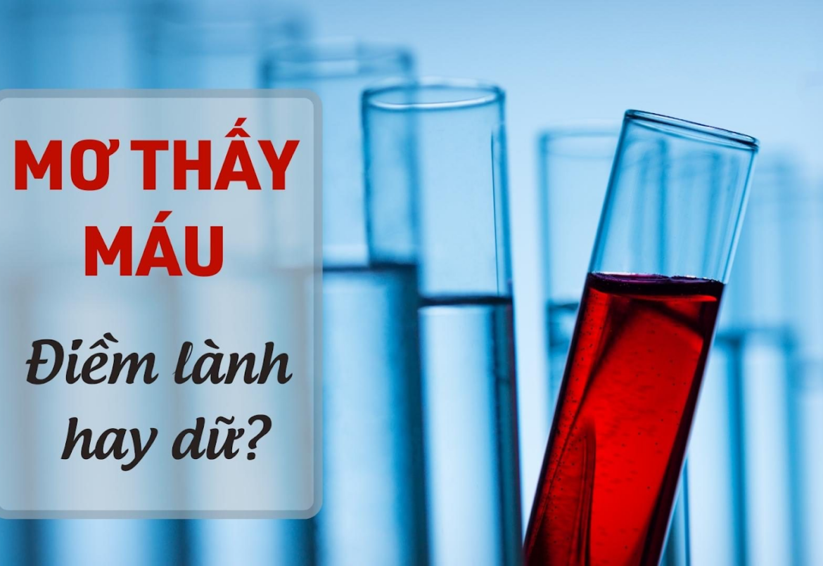 Nằm mơ thấy máu báo hiệu điềm gì?